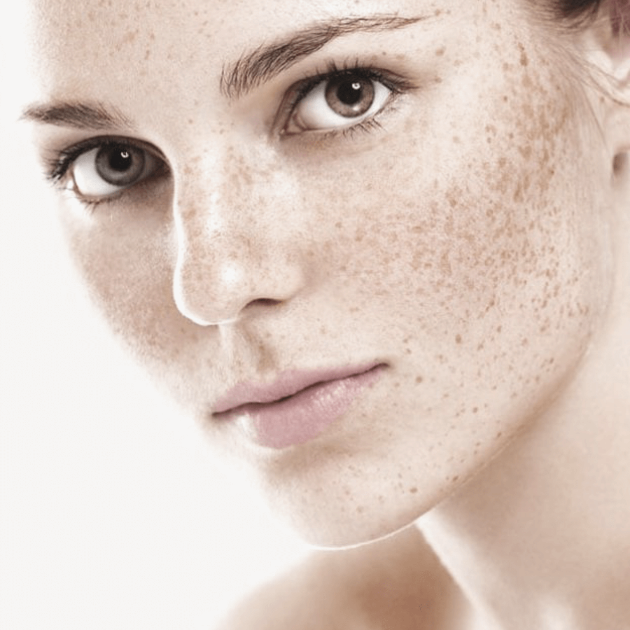 sun spots